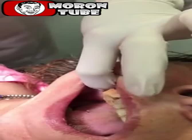 Video :It's incredible what this dentist is extracting from his mouth!